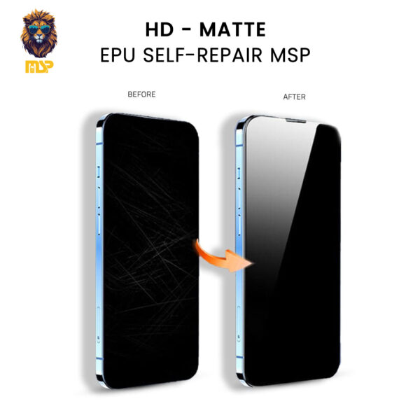 ‏EPU HD Self-Repair 12×18cm